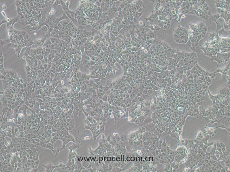 HePa1-6-GFP (小鼠肝癌细胞（绿色荧光标记）) (STR鉴定正确)