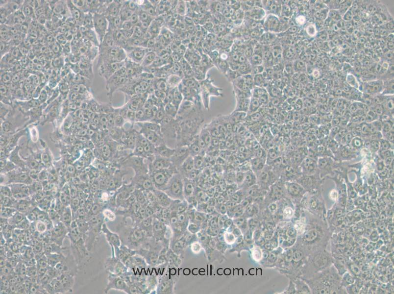 HePa1-6-GFP (小鼠肝癌细胞（绿色荧光标记）) (STR鉴定正确)