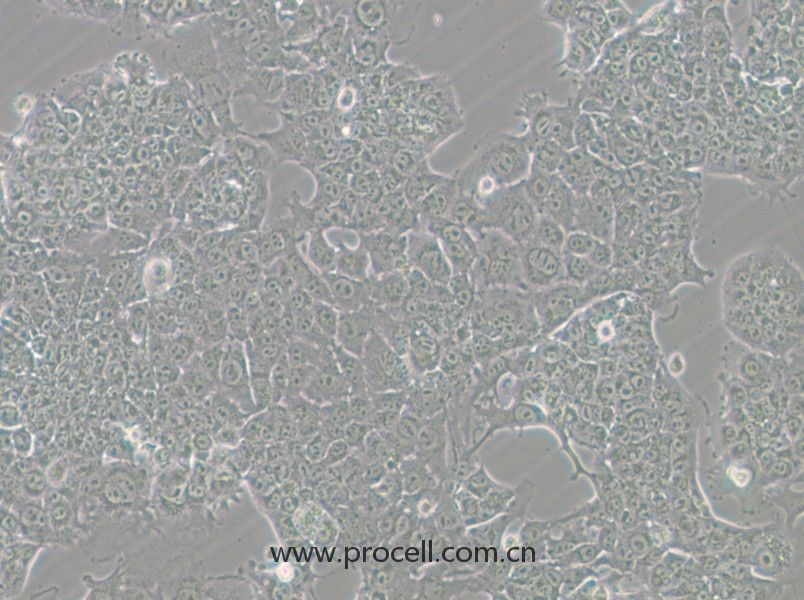 HePa1-6-GFP (小鼠肝癌细胞（绿色荧光标记）) (STR鉴定正确)