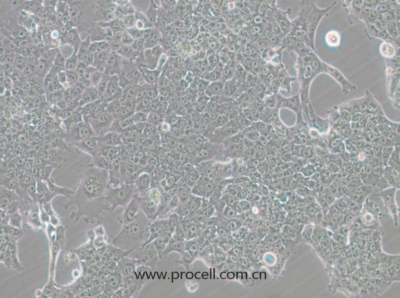 HePa1-6-GFP (小鼠肝癌细胞（绿色荧光标记）) (STR鉴定正确)