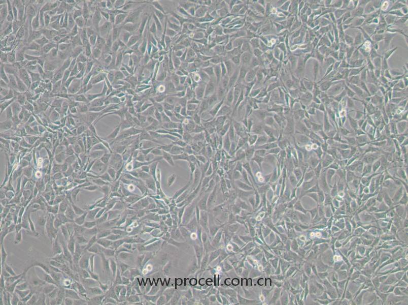 NIH/3T3-GFP（小鼠胚胎细胞（绿色荧光标记））(STR鉴定正确)