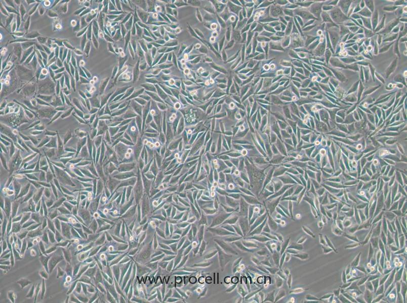 PC-3-GFP (人前列腺癌细胞（绿色荧光标记）) (STR鉴定正确)