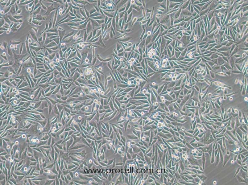 PC-3-GFP (人前列腺癌细胞（绿色荧光标记）) (STR鉴定正确)