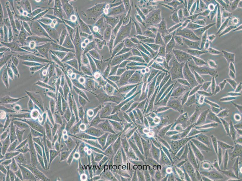 PC-3-GFP (人前列腺癌细胞（绿色荧光标记）) (STR鉴定正确)