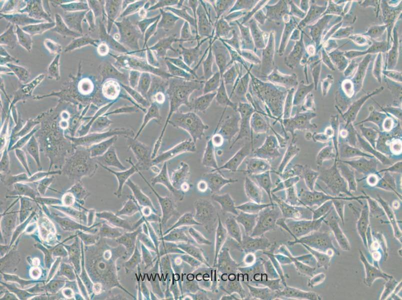 PC-3-RFP (人前列腺癌细胞（红色荧光标记）) (STR鉴定正确)