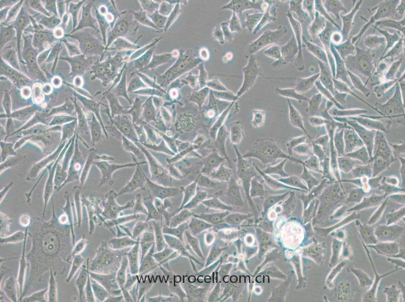 PC-3-RFP (人前列腺癌细胞（红色荧光标记）) (STR鉴定正确)