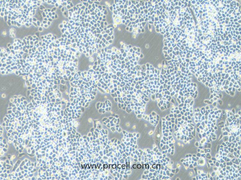 HCT-15-5FU (人结直肠癌氟尿嘧啶耐药株) (STR鉴定正确)