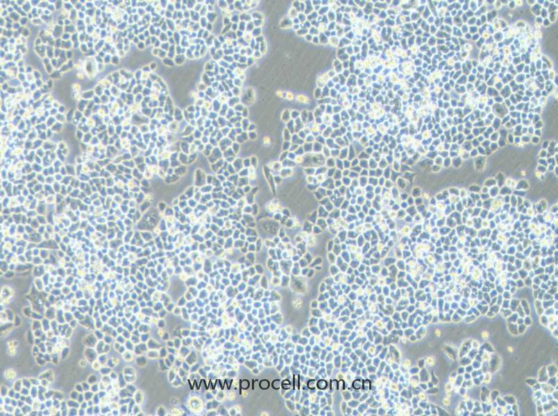 HCT-15-5FU (人结直肠癌氟尿嘧啶耐药株) (STR鉴定正确)