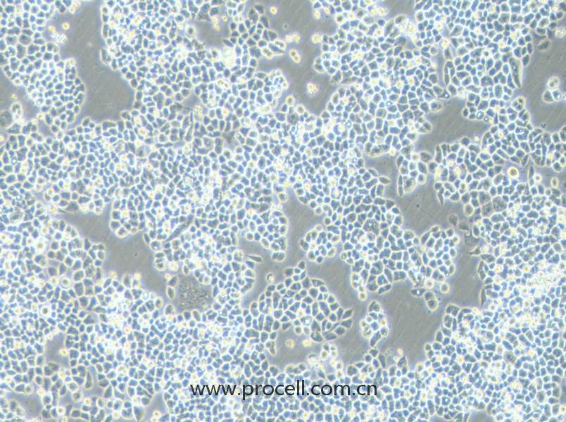 HCT-15-5FU (人结直肠癌氟尿嘧啶耐药株) (STR鉴定正确)