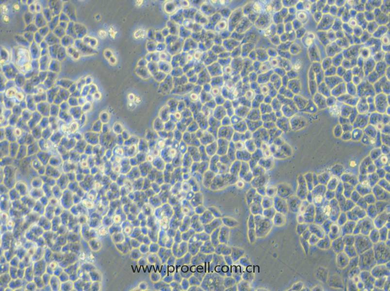 HCT-15-5FU (人结直肠癌氟尿嘧啶耐药株) (STR鉴定正确)