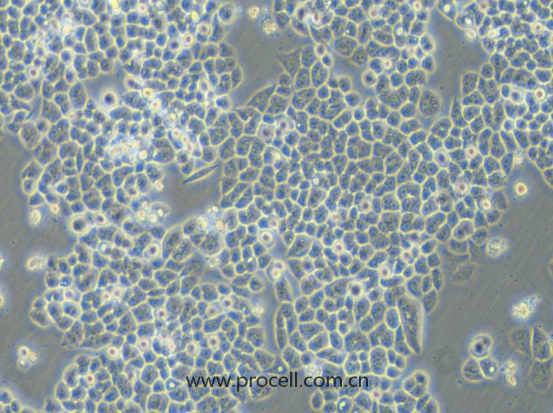 HCT-15-5FU (人结直肠癌氟尿嘧啶耐药株) (STR鉴定正确)