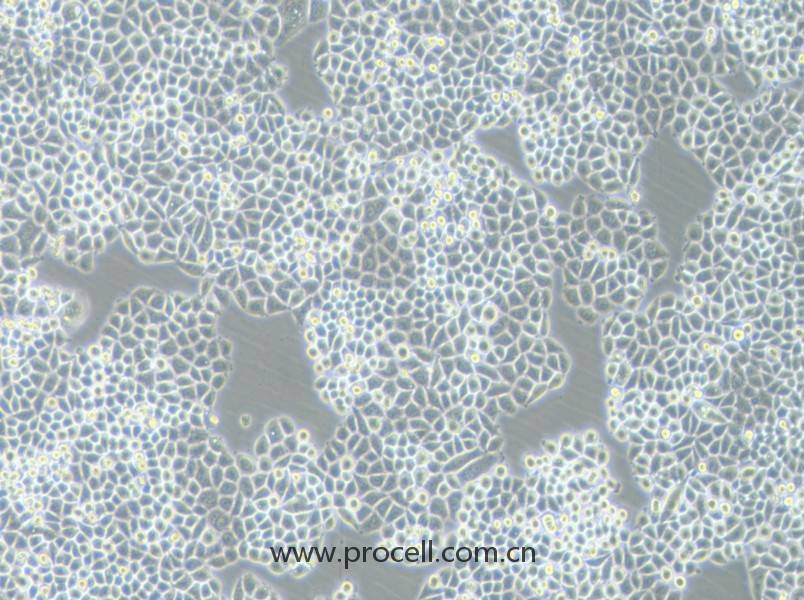 PC-9-DDP (人非小细胞肺癌细胞顺铂耐药株) (STR鉴定正确)