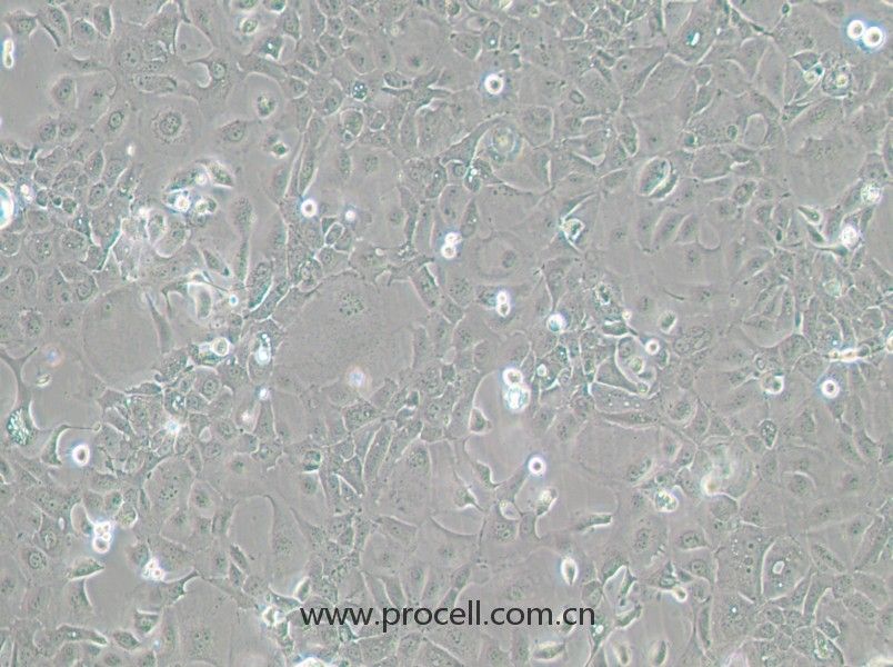 Panc 02.13（人胰腺癌细胞）（STR鉴定正确）