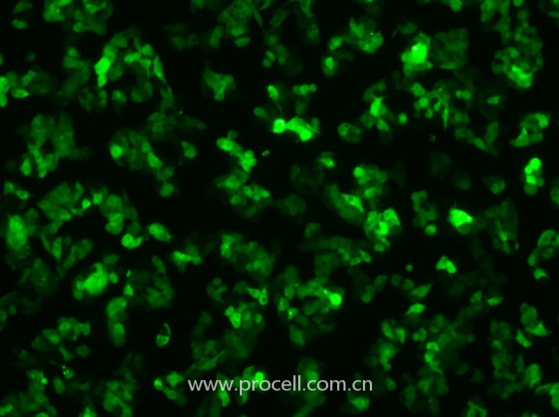 Hep G2-GFP（人肝癌细胞（绿色荧光蛋白标记））（STR鉴定正确）