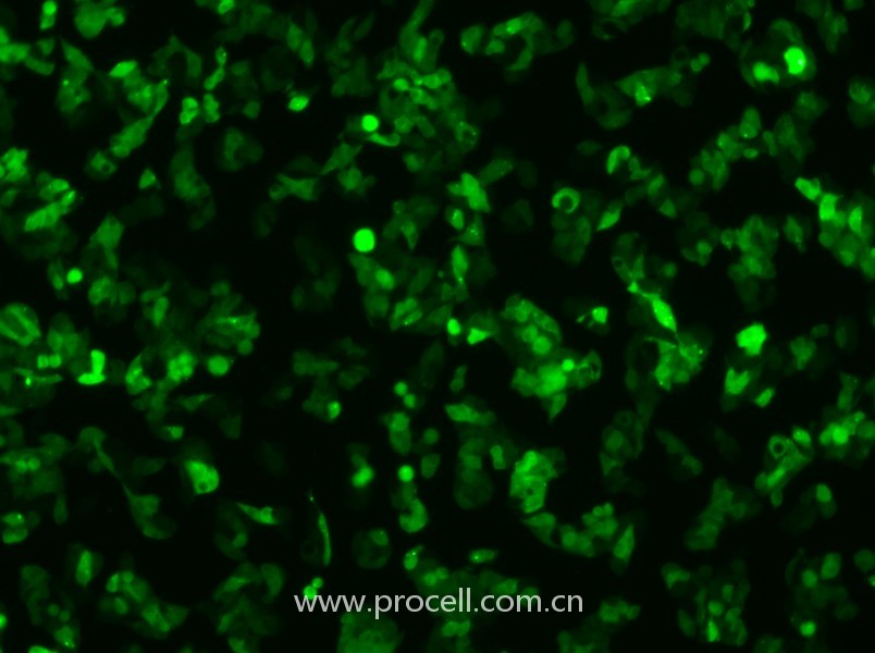 Hep G2-GFP（人肝癌细胞（绿色荧光蛋白标记））（STR鉴定正确）