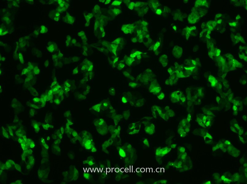 Hep G2-GFP（人肝癌细胞（绿色荧光蛋白标记））（STR鉴定正确）