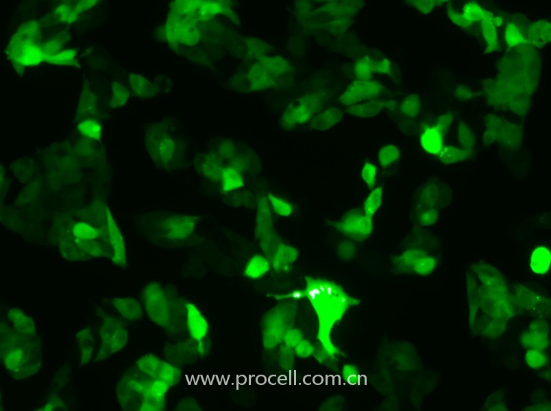Hep G2-GFP（人肝癌细胞（绿色荧光蛋白标记））（STR鉴定正确）