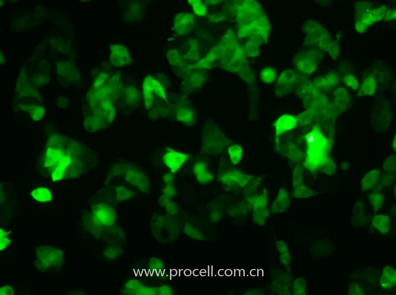 Hep G2-GFP（人肝癌细胞（绿色荧光蛋白标记））（STR鉴定正确）