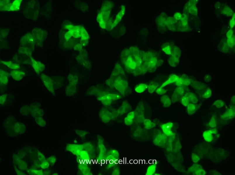Hep G2-GFP（人肝癌细胞（绿色荧光蛋白标记））（STR鉴定正确）