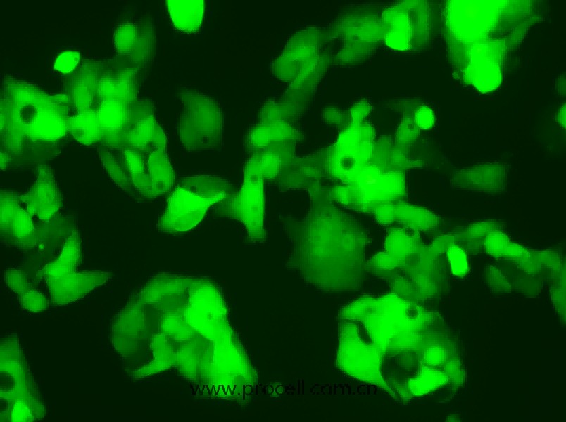 Hep G2-LUC-EGFP（人肝癌细胞（荧光素酶绿色荧光标记））（STR鉴定正确）