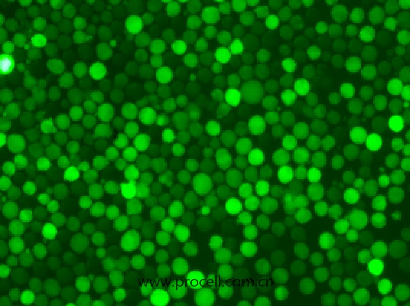 K-562-GFP（人慢性髓原白血病细胞（绿色荧光标记））（STR鉴定正确）