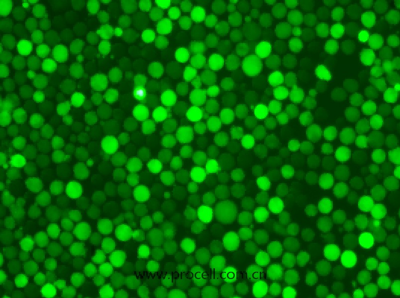 K-562-GFP（人慢性髓原白血病细胞（绿色荧光标记））（STR鉴定正确）