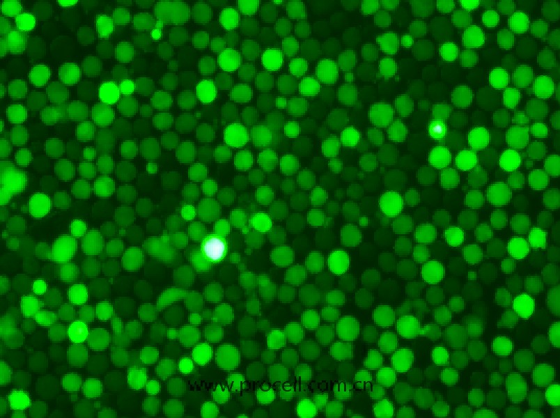 K-562-GFP（人慢性髓原白血病细胞（绿色荧光标记））（STR鉴定正确）