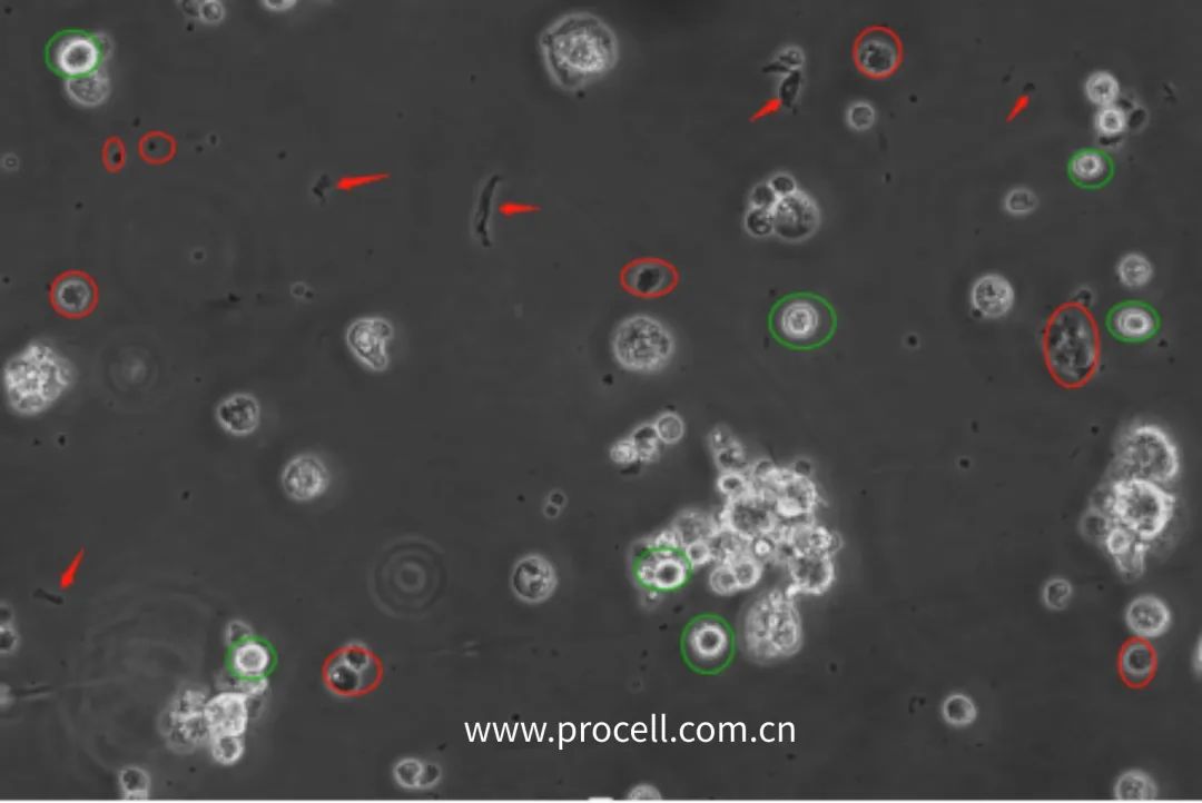 红色圈为死细胞；绿色圈为活细胞；箭头为血清杂质
